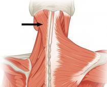 Ременные головы и шеи Части ременной мышцы