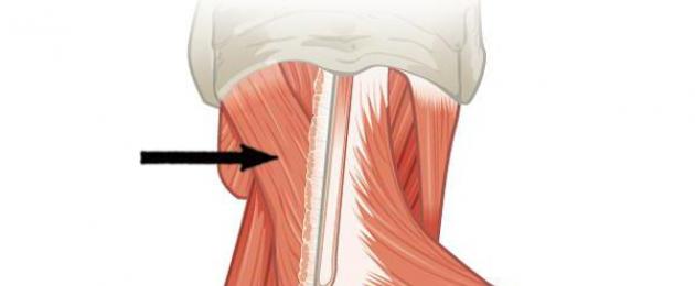 Где находится ременная мышца шеи. Ременные головы и шеи Части ременной мышцы
