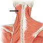 Ременные головы и шеи Части ременной мышцы